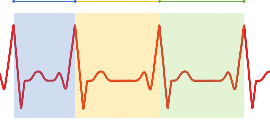 Representación esquemática de la variabilidad de la frecuencia cardíaca con cuatro latidos y diferencias en el intervalo entre picos.